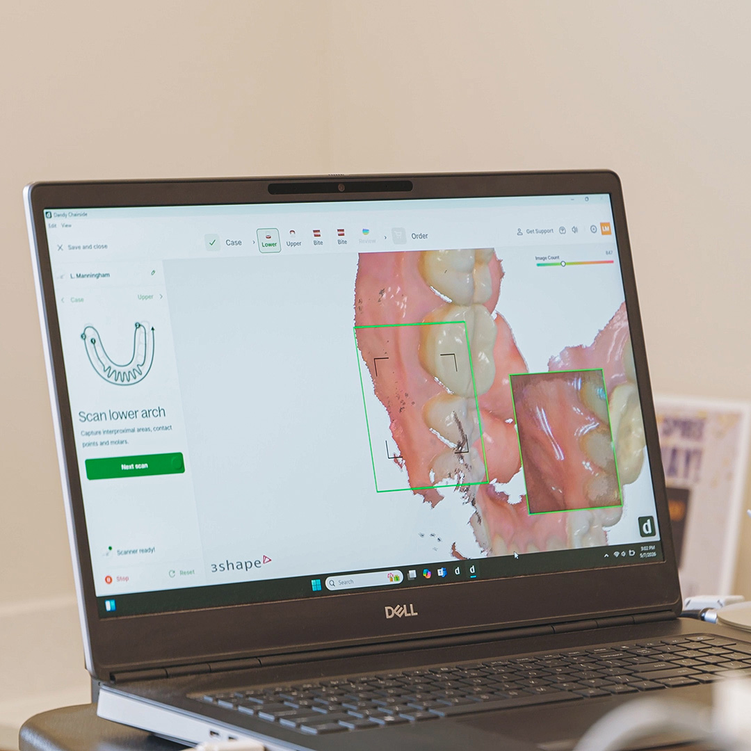 Dental Bridge Dentist Brighton Mi